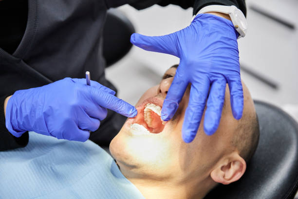 Best Emergency Dental Care for Broken or Chipped Teeth in Versailles, MO